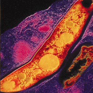 антитела к туберкулезу